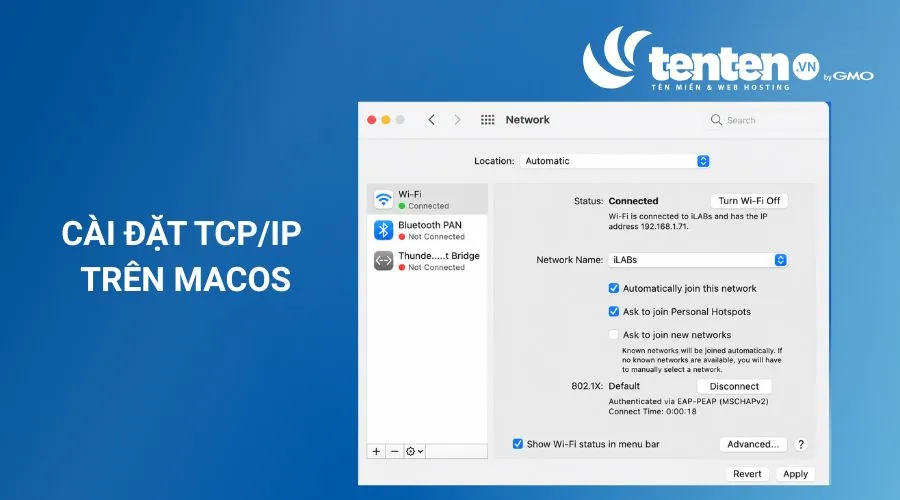 Nhấp chuột phải vào biểu tượng Wifi (Ethernet), sau đó chọn Open Network Preferences, chọn Advanced.