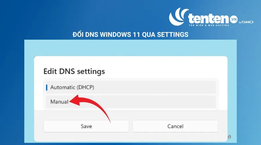 Chuyển chế độ từ “Automatic (DHCP)” sang Manual. 
